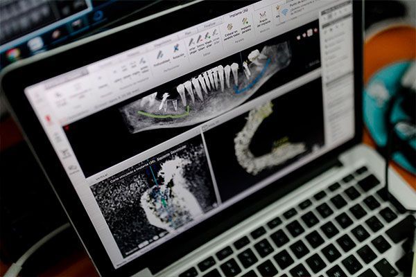 curso de formacion en implantologia en España