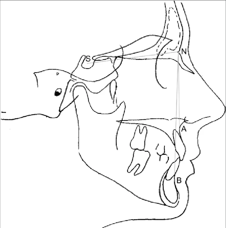 cefalometria steiner